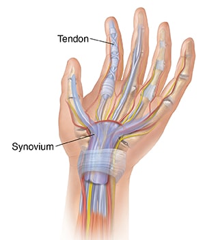 Image of hand depicting synovium and tendons