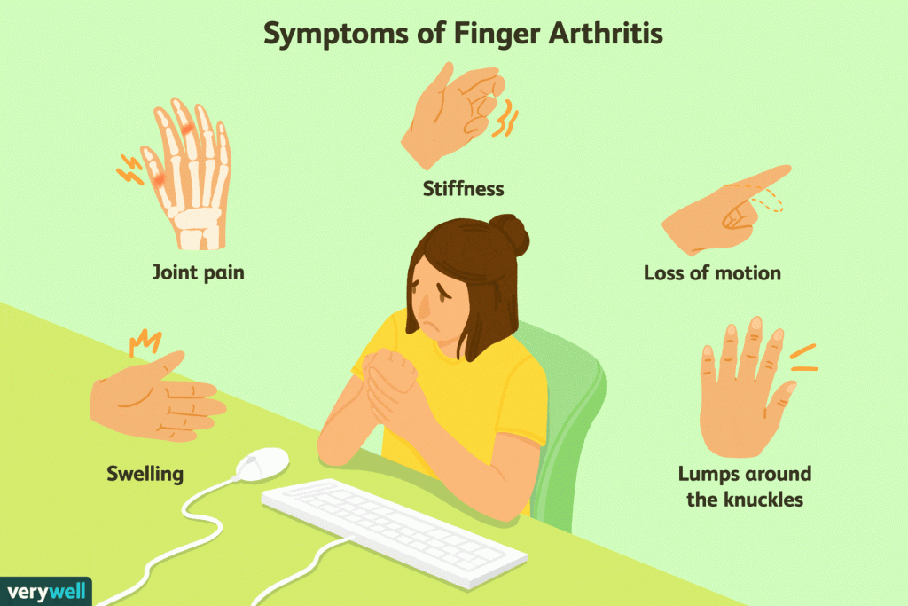 Image of different symptoms of finger arthritis such as joint pain, stiffness, loss of motion, lumps around the knuckles and swelling